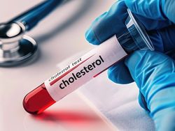 Hound - cholesterol blood test crop