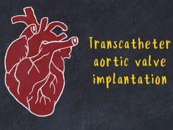 Delayed Total Atrioventricular Block After Transcatheter Aortic Valve  Replacement Assessed by Implantable Loop Recorders