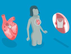 20260616_TAVR studies_BS