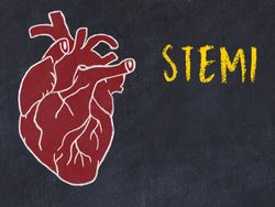 20260205_STEMI_BS