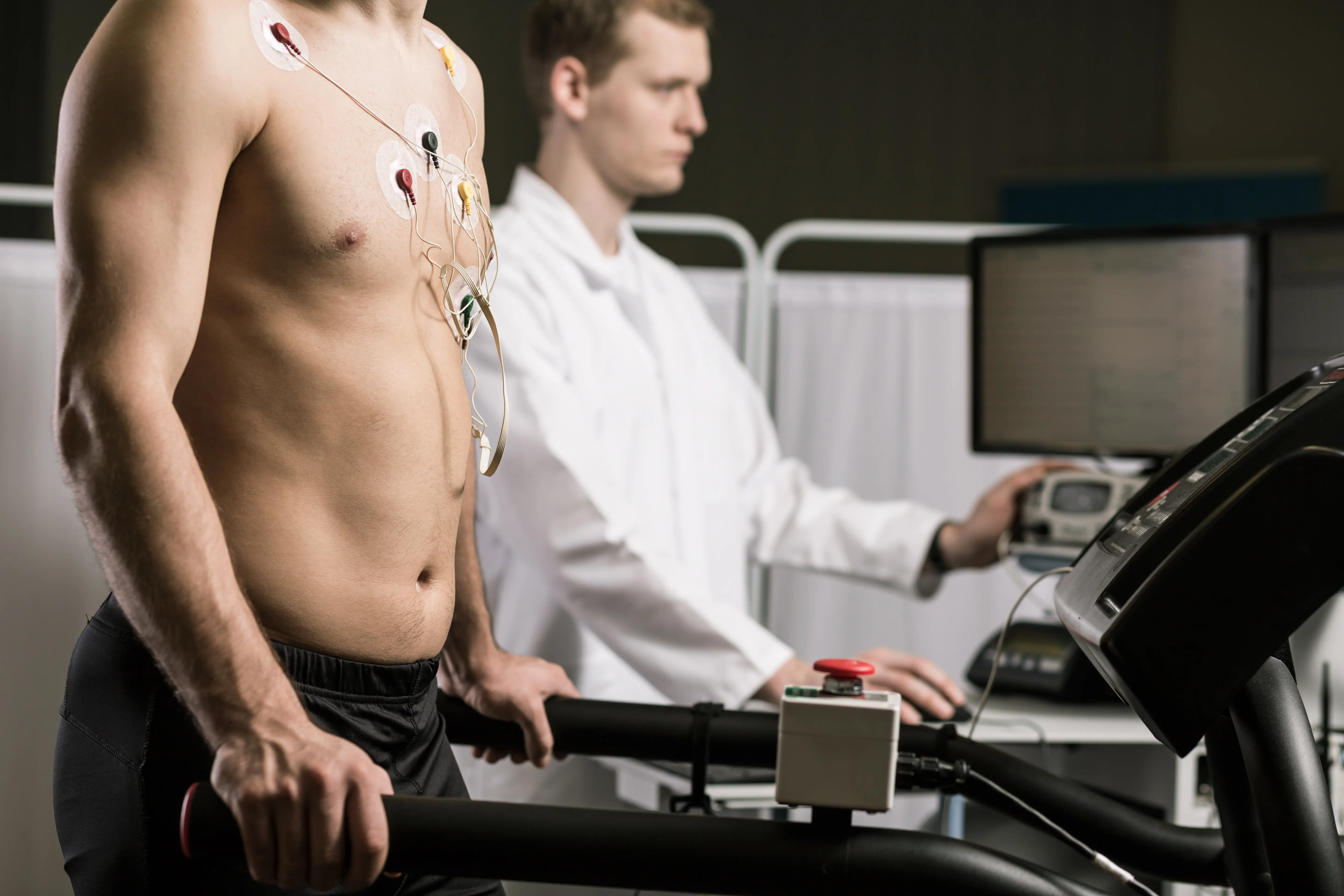 PVCs During Recovery, But Not During Exercise Testing, May Be Linked