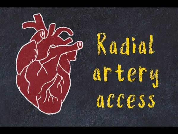 Distal Radial Access Safe, With Low Complication Rates, Similar Success ...